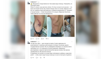 «Денесін күйдіріп, саусақтарын сындырды»: «Қазақмыс» қызметкері 8 жастағы баланы азаптаған (ФОТО)